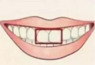 测试：你的门牙属于哪种？看你天生是不是缺钱花！