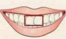 测试：你的门牙属于哪种？看你天生是不是缺钱花！