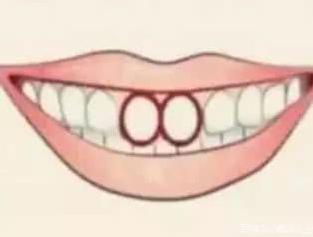 测试：你的门牙属于哪种？看你天生是不是缺钱花！ 1