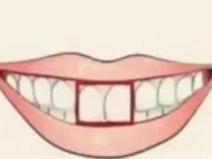 测试：你的门牙属于哪种？看你天生是不是缺钱花！ 3