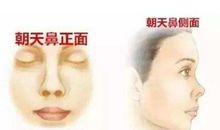 男人女人有着朝天鼻面相一生中是没有福气的