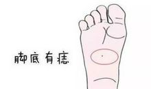 脚心长痣有什么含义，代表贵气，运势好