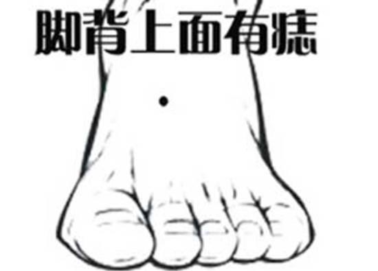 男人脚背长痣代表什么，代表奔波劳碌，招小人 1