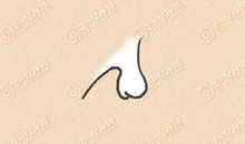 鹿鼻子的人是什么样子 命运如何