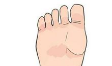 男人脚底心长痣代表什么，代表荣华富贵和权利