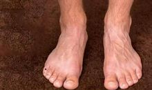 男人右脚小趾有痣，对待感情十分火热，持久度低