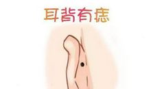耳朵后面有痣代表什么 怎么解释