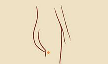 大腿根有痣的女人代表什么，生活幸福美满？