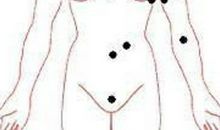 女人私处有痣是富贵痣，代表大富大贵