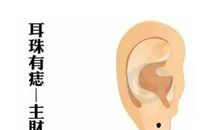 哪里有痣是好命的象征，耳垂先天有痣好命