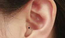 好命痣长在什么部位，长在右耳