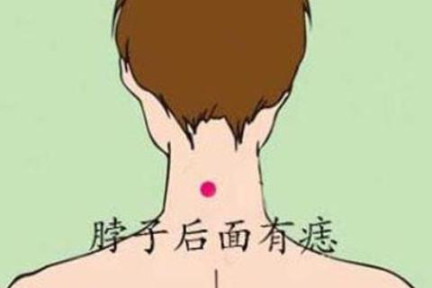 男人女人脖子后面有痣是什么意思，好不好