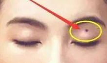 富贵痣的位置，田宅宫，下巴，鱼尾有痣大富大贵