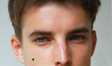 身上有这几种痣、千万别点掉、注定位高权重，大富大贵！