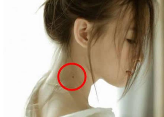 女人脖子左侧长痣图片