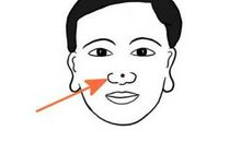 男人面部痣相最准图，鼻子，下巴颧骨有痣面相好