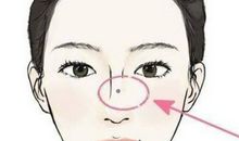 女人10处有痣是富贵痣，鼻子两侧和下巴的痣是富贵痣