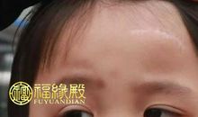 面相有疤 额头有疤面相