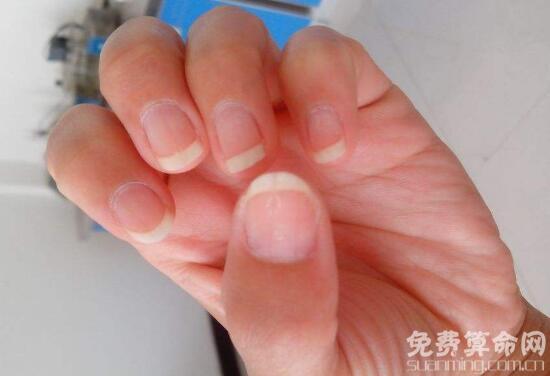 指甲上的月牙代表什么，通常代表着人们的身体健康 1