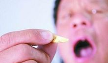 做梦梦到掉牙建议要控制好自己的情绪，慎防小人