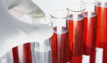 梦见血液病什么意思？生意人南方有利