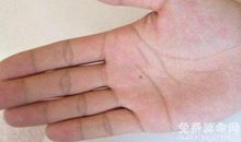 手上不同位置长痣的含义，手背上长痣会有贵人相助