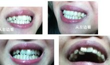 从牙齿看你性格命运