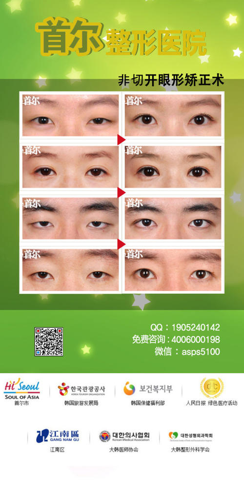 男生眼睛形状分类图片