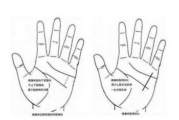 从手相保健线看您的健康