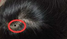 身上这几颗痣保你逢凶化吉