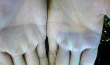 双手断掌的男人