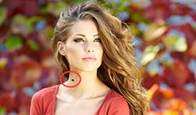 脖子上长痣是好事还是坏事?注意痣的位置