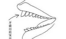 暴牙面相对性格运势的影响