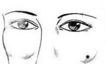 哪些痣代表着好运