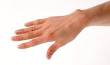 痣相图解：女人手背长痣代表什么