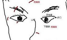 脸上疤痕和痣相对运气的影响