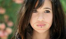 面部中哪些痣相预示着个人的健康状况下滑?