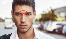 痣相分析：这些位置上长痣的男性容易出轨