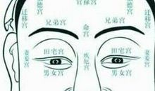 哪些痣相预示着财源滚滚