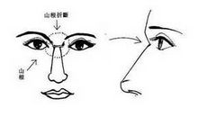 男性面相特征图解：山根的含义