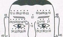 面相痣图解：脸上长痣