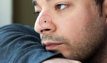 注意!有这些痣的男人在工作情感中靠不住