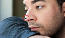 男子拥有这几种痣，将会大富大贵