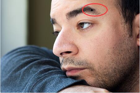 男性眉毛中痣的特殊含义是什么？
