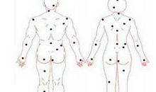 身上有痣究竟是好还是坏？