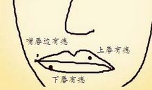 嘴唇长痣吉凶