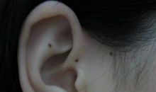 耳朵后长痣是否小人多