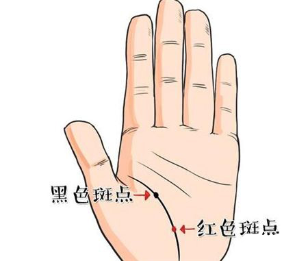 三种表示健康问题的手印1