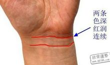 手相玉环纹看出你的健康状况