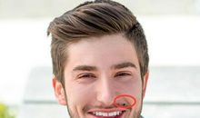 哪些痣象征着性格自私人际关系糟糕?